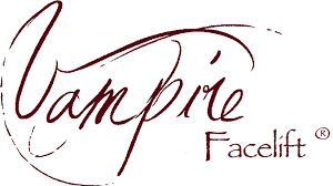 Vampire Facelift